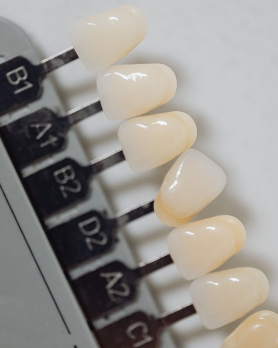 Bọc sứ & Veneer