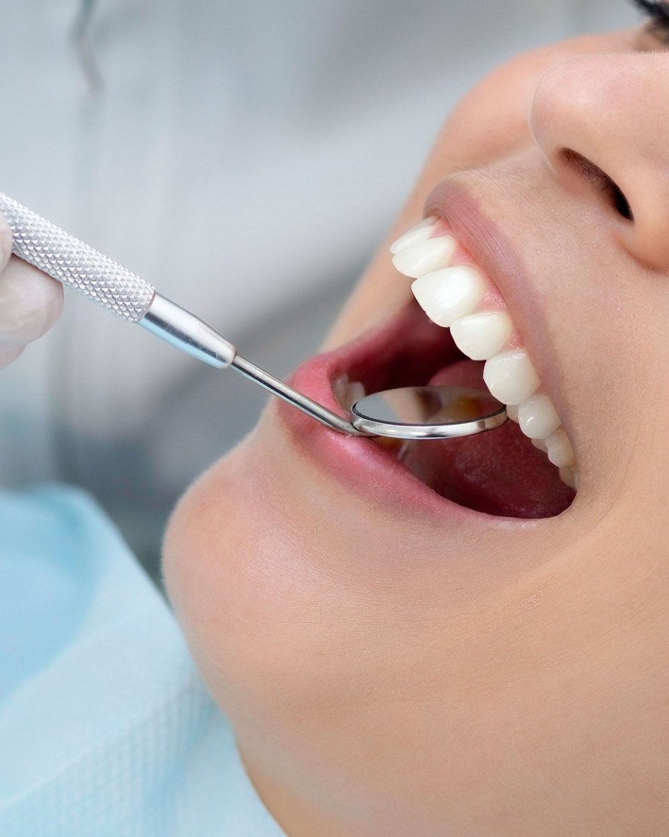 Khám tổng quát & cạo vôi