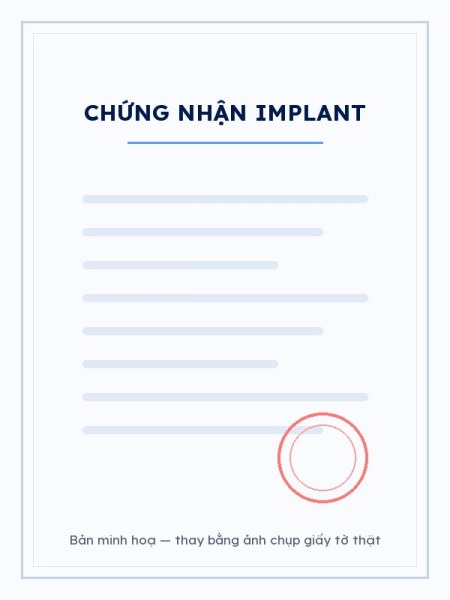 Trung tâm cấy ghép Implant đạt chuẩn