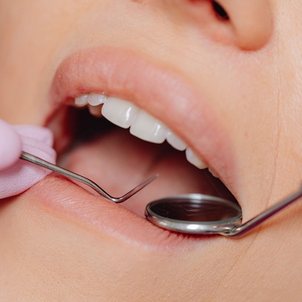 Khám tổng quát & chụp phim toàn cảnh